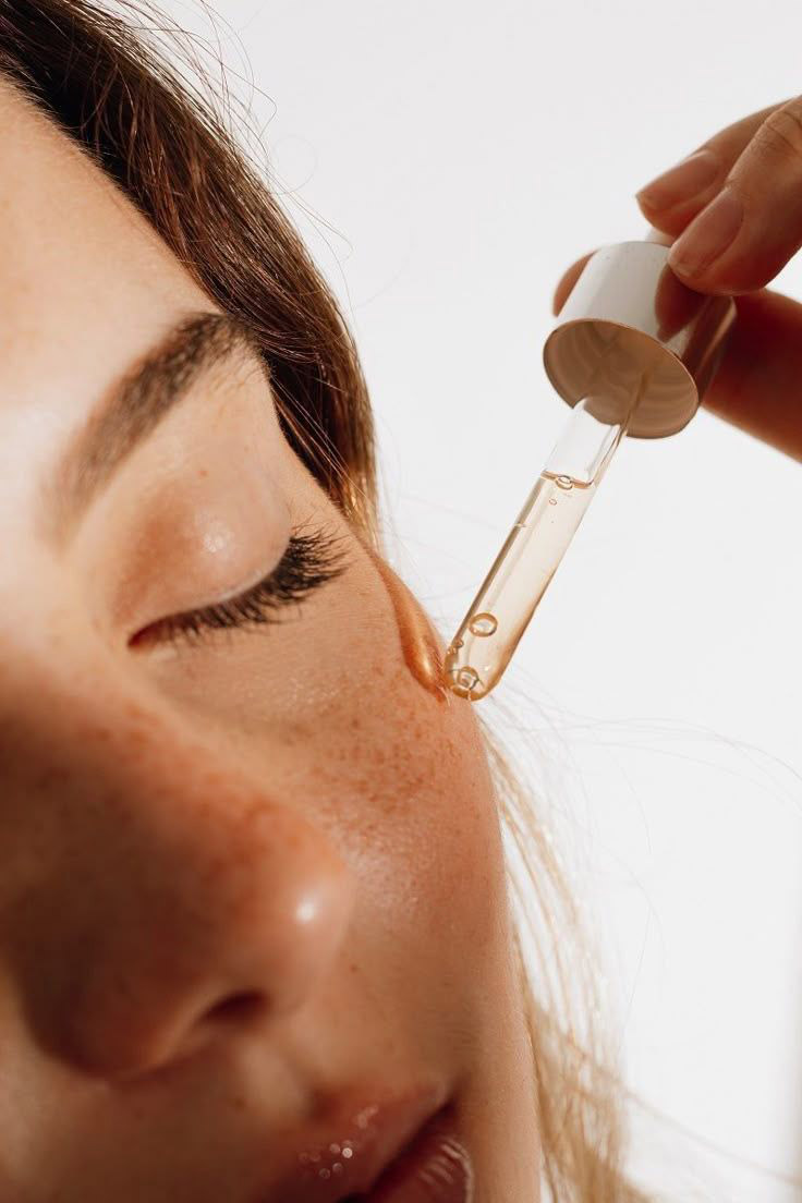 hyperpigmentation